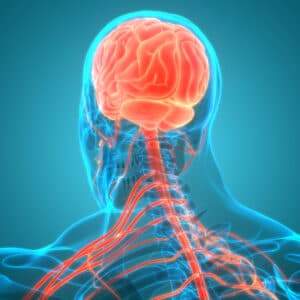 Strokes and Vascular Dementia